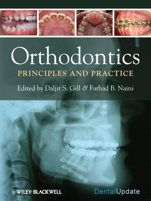 Orthodontics By Daljit S Gill 183 Overdrive Rakuten